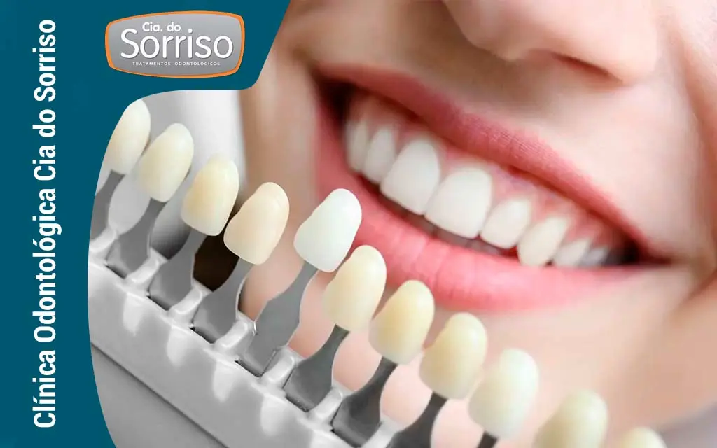 Dentística Estética em Blumenau - Clínica Cia do Sorriso