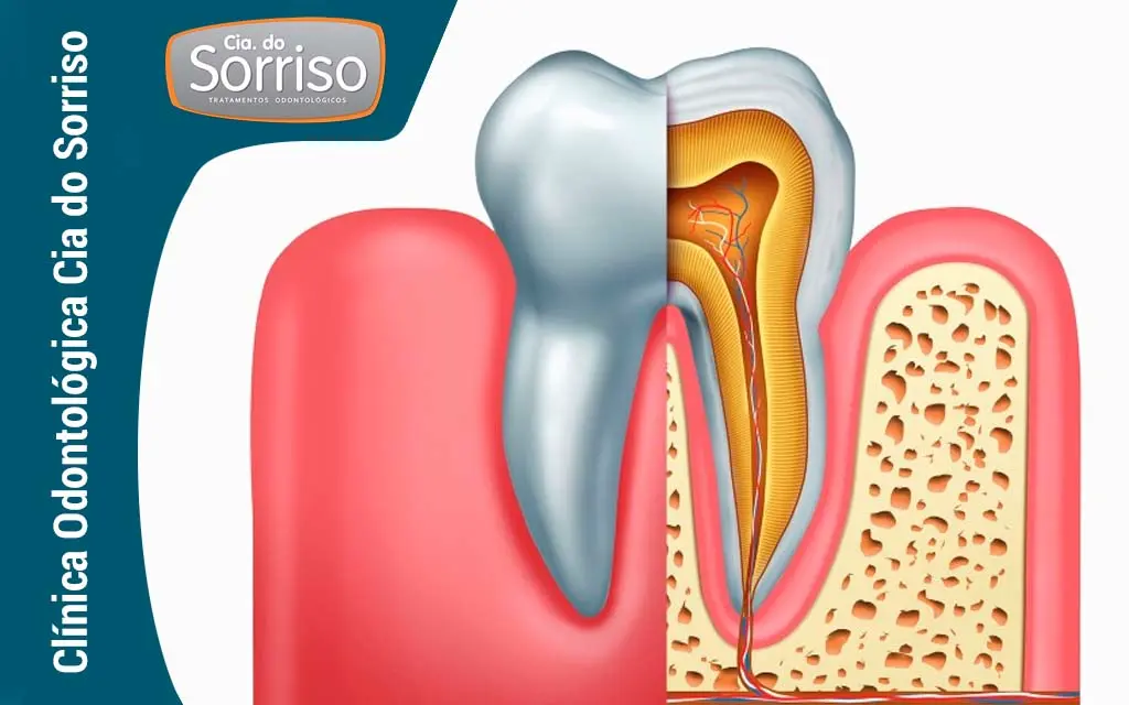 Endodontia - Clínica Cia do Sorriso - Blumenau/SC