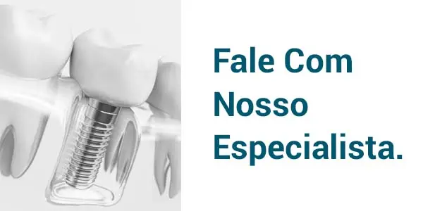 Especialista em Implantes - Cia do Sorriso Blumenau