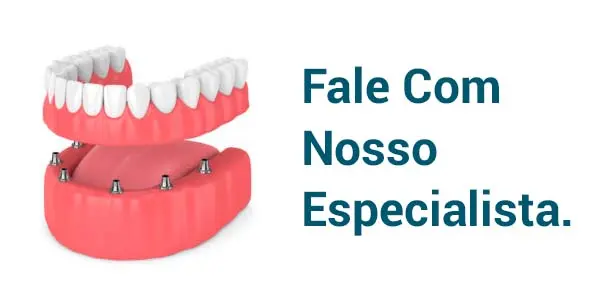 Especialista em Prótese Protocolo em Blumenau - Clínica Cia do Sorriso