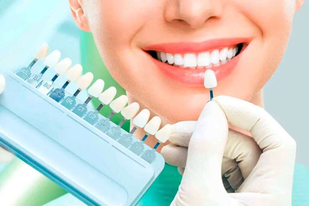 Facetas Dentárias em Blumenau/SC