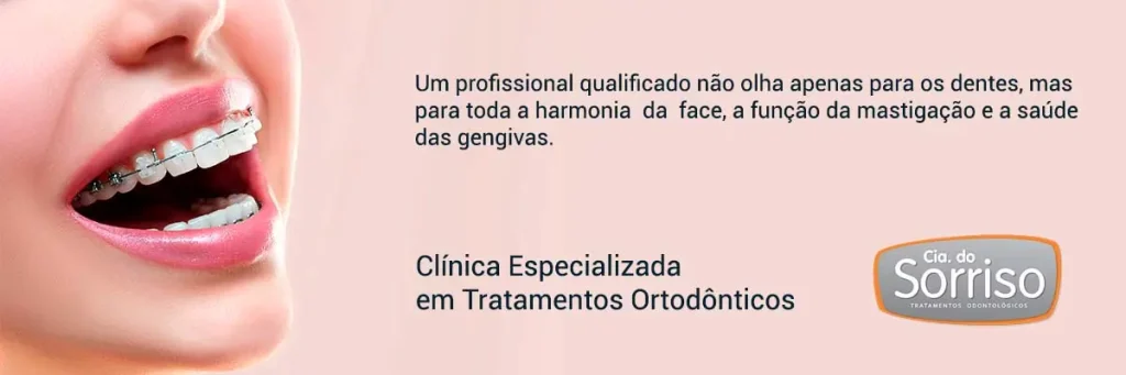 Especialistas em Aparelhos Ortodônticos em Blumenau e Região. - Cia do Sorriso.