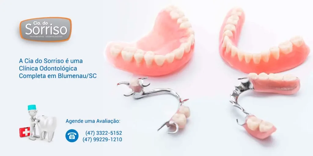 Prótese Removível em Blumenau - Cia do Sorriso Clínica Odontológica em Blumenau/SC.